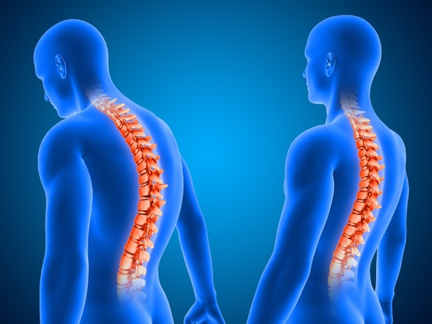 IS IT SAFE TO HAVE THE SPINE CRACKED?
